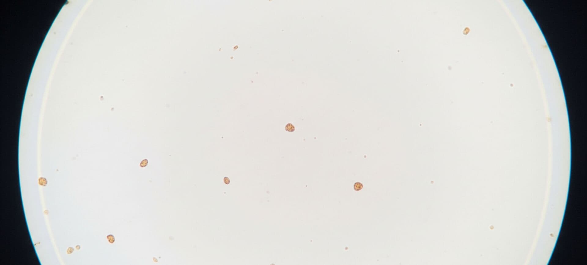 Small contaminant particles collected on a filter membrane
